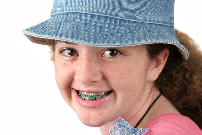 free dental braces for children