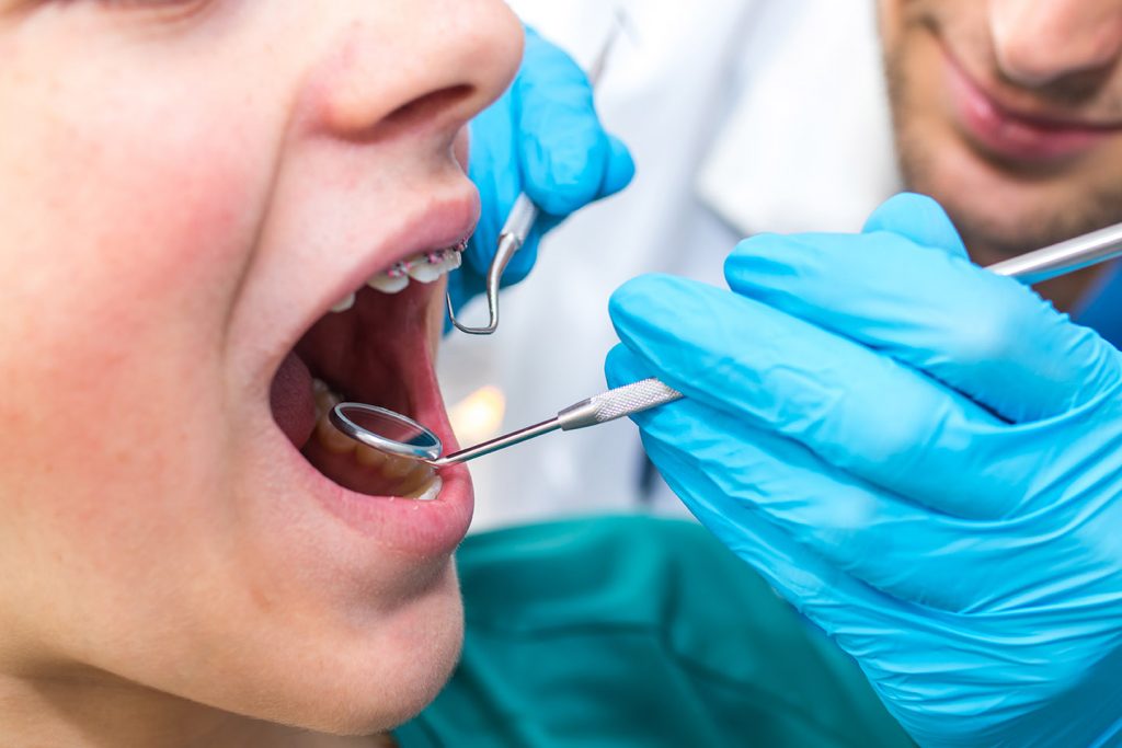 Why Parents are Bypassing Long NHS Waiting Lists for Children’s Orthodontic Treatment