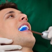Why Dental Bonding Is a Popular Cosmetic Option.