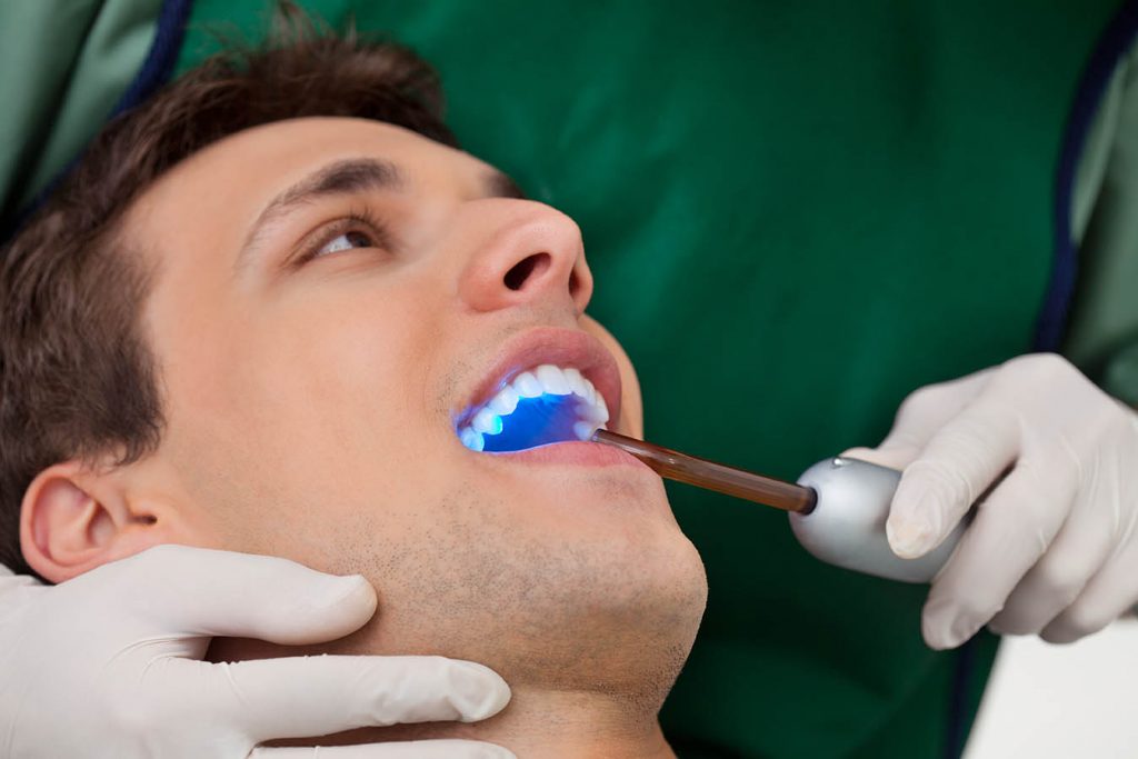 Why Dental Bonding Is a Popular Cosmetic Option.