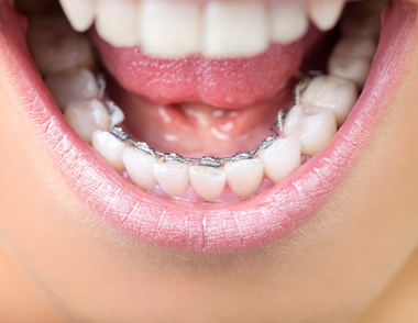 Specialist Orthodontists