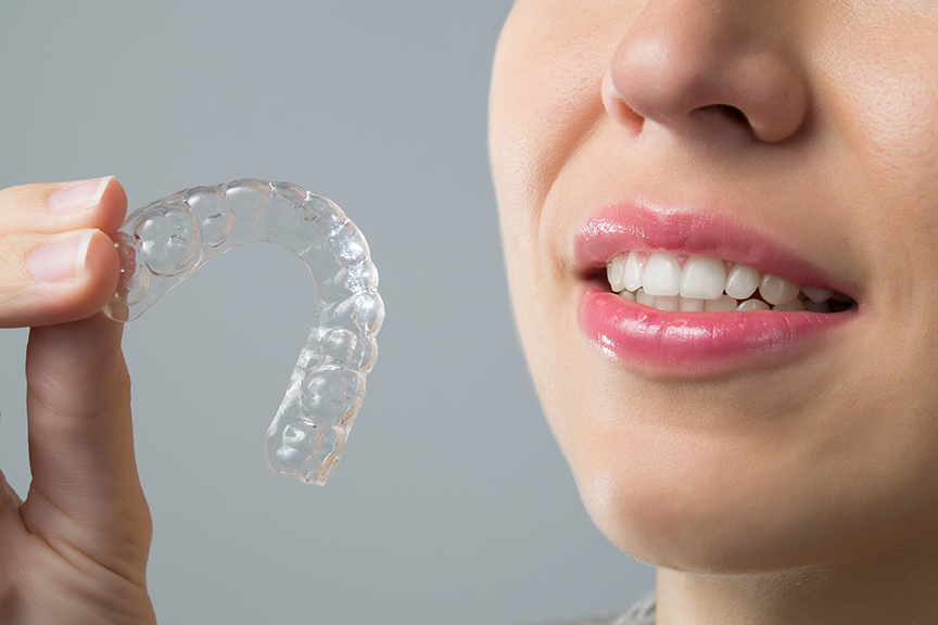 invisalign services at Ridgway Dental in Wimbledon Village London SW19
