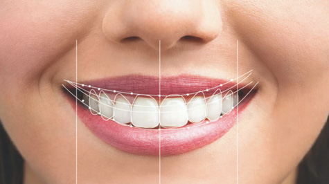 What will my new smile look like?